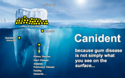 Image of a tooth iceberg representing the fact gum disease in dogs is more than what you see on the surface